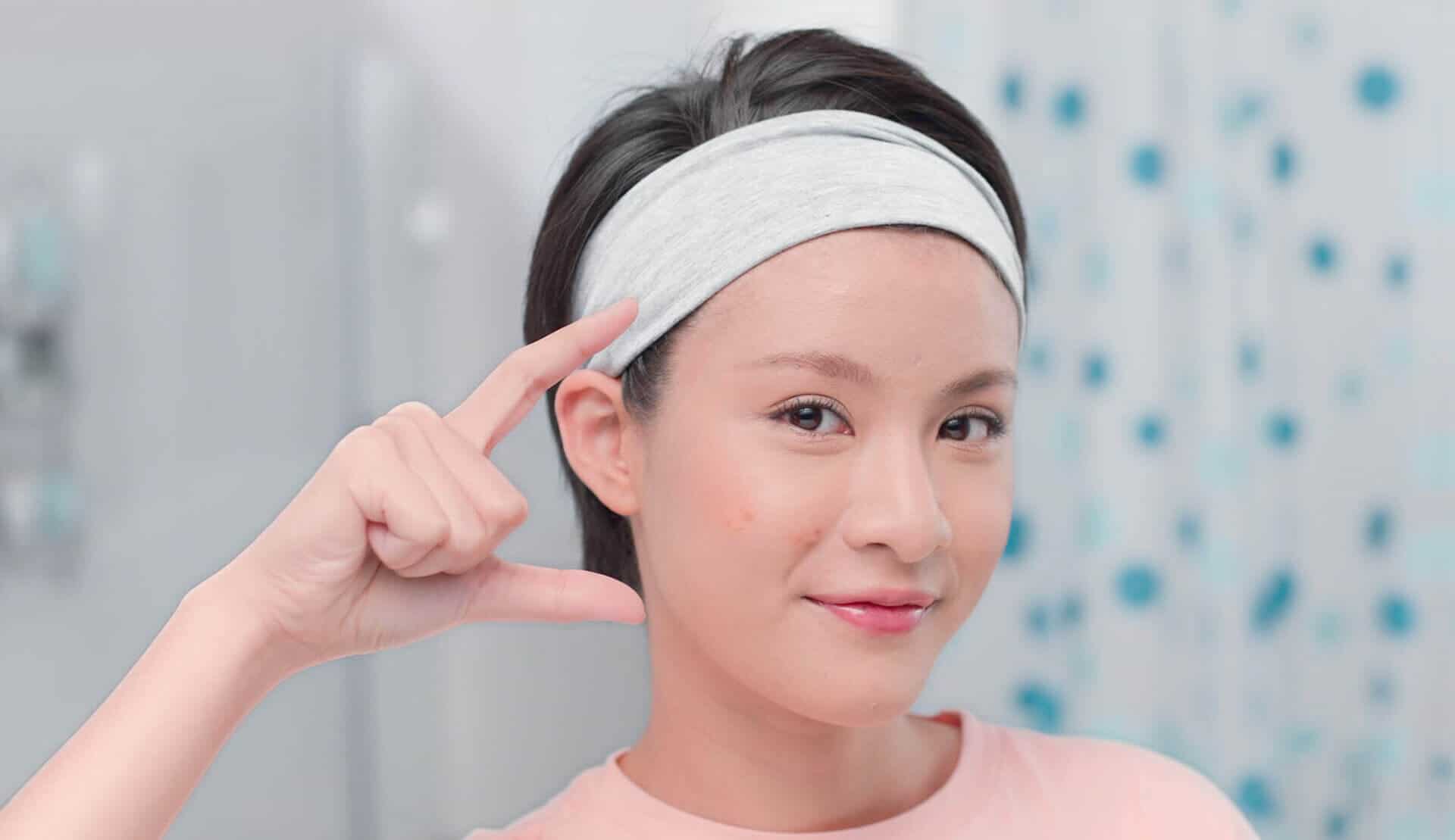Acne Scarring ( Bahasa Article ) Acne Scarring ( Bahasa Article )